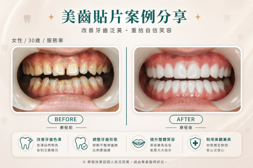 色澤不均，影響整體乾淨度