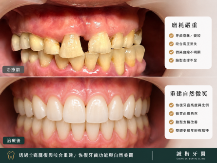 她以為只是變老了