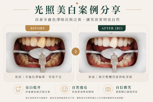自然系光照美白｜提升亮度與乾淨感