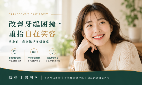 改善門牙縫隙，笑容更自在