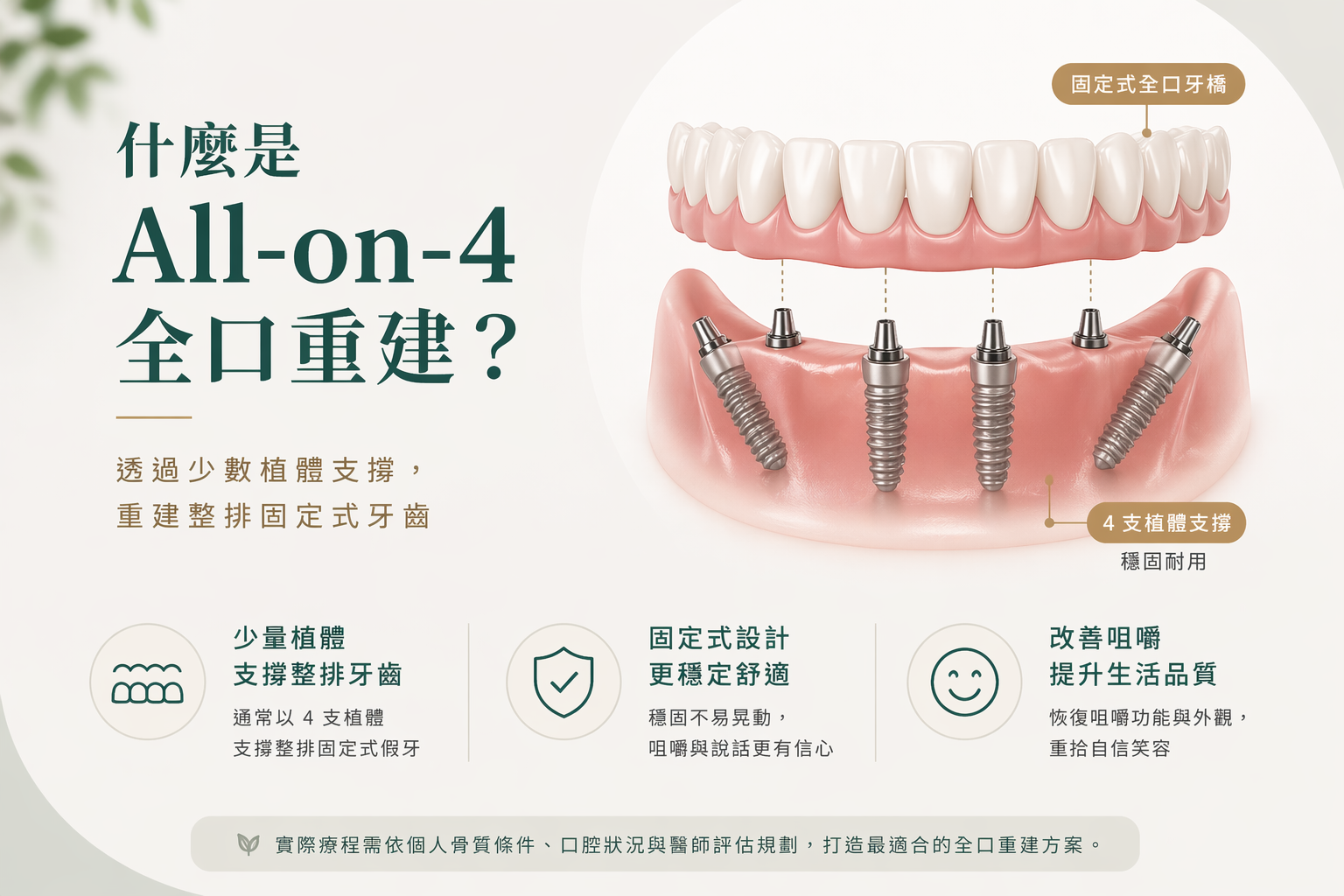 什麼是 All-on-4 全口重建